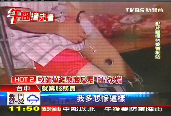 車禍截肢找工作 10年碰壁上百次