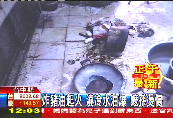 炸豬油起火 澆冷水油爆 嬤孫燙傷