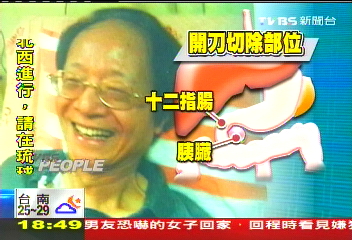 〈獨家〉食慾不振有異 金恆煒驚傳罹胰臟癌