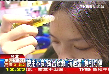 使用不良? 蜜蜂爺爺「抗痘露」竟引灼傷