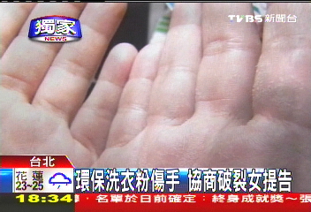 〈獨家〉環保洗衣粉傷手　協商破裂女提告
