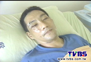 花心男搶奪養5女友　拒捕傷警毀容