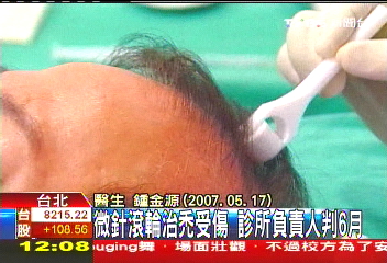 微針滾輪治禿 無牌醫代打遭判刑