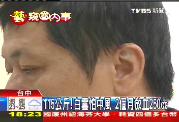 太胖怕中風!白雲放血 噴出「黑血」