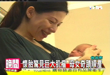 懷胎驚見巨大肌瘤　母女奇蹟順產