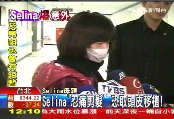 火吻Selina／Selina「忍痛剪髮」　恐取頭皮移植