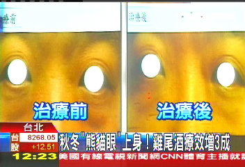秋冬「熊貓眼」上身! 雞尾酒療效增3成
