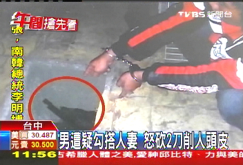 男遭疑勾搭人妻 怒砍2刀削人頭皮