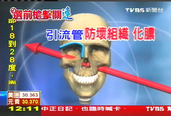 連勝文堅持即可出院 台大:得觀察