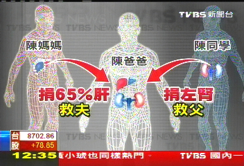 骨肉親情!母子捐肝腎 搶救病危父