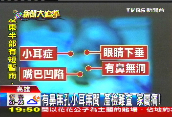 有鼻無孔小耳無聞　產檢難查家屬痛！