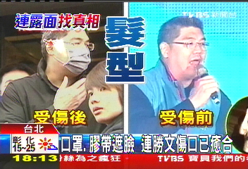 「臉貼膠帶淡疤」 連勝文不用整形