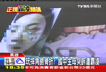 玩摔角臉骨折？　國中生母哭訴遭霸凌