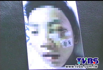 摔角玩到骨折？　國中生母控遭霸凌