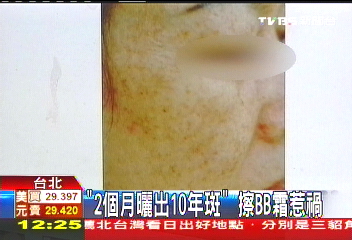 「2個月曬出10年斑」 擦BB霜惹禍