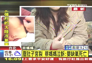 壓肚助產 24歲女子宮裂　嬰缺氧死