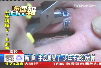 痛啊！手沒感覺了　少年卡戒90分鐘