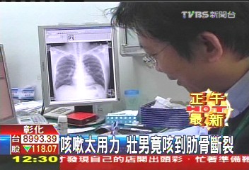 咳嗽太用力　壯男竟咳到肋骨斷裂