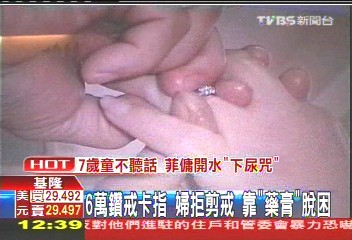 6萬鑽戒卡指!婦拒剪戒 靠「藥膏」脫困