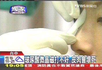 〈獨家〉玻尿酸微晶瓷打不好 皮肉會壞死