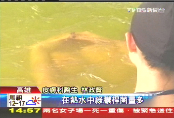 泡湯拚命搓鹽巴 小心感染毛囊炎!