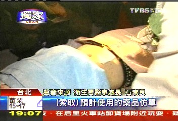 〈獨家〉治禿打柔沛? 揪美塑「不明」針劑