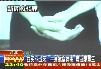 癱瘓能走了!鋼筷插頸傷脊髓 有救