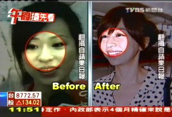 出院後「鼻樑」變挺? 王心凌遭質疑整形