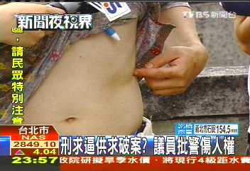 刑求逼供求破案? 議員批警傷人權