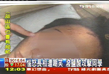爭第一?嘲笑長相? 大學生潑酸報復