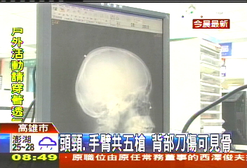 高市青少年持刀槍械鬥　1中彈1刀傷