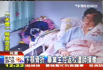 下顎骨折　畢業生控返校遭師揮拳