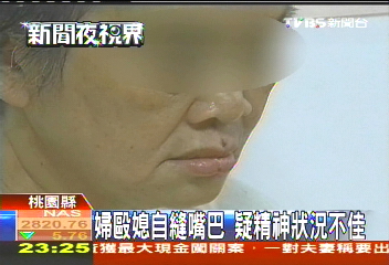 婦毆媳自縫嘴巴　疑精神狀況不佳