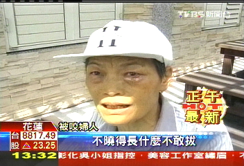 全球首例 台灣革蜱寄生啃婦眼瞼