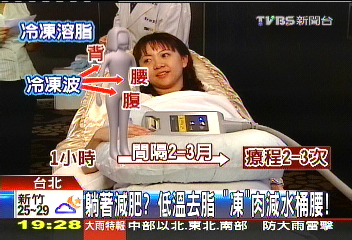 躺著減肥?低溫去脂 「凍」肉減水桶腰!