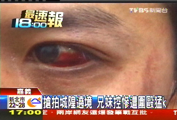 搶拍城隍遶境 兄妹控慘遭圍毆猛K