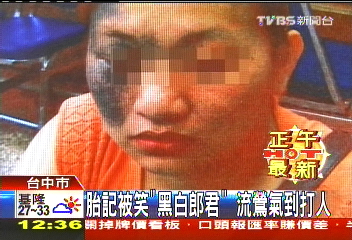 胎記被笑「黑白郎君」 流鶯氣到打人