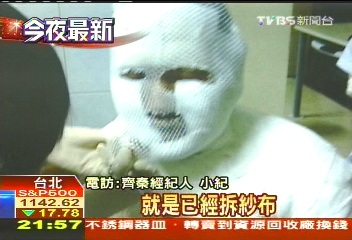火傷後首露面! 齊秦搭機赴美療傷