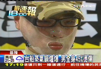 台船蒸氣鍋爐爆 男全身45%燙傷