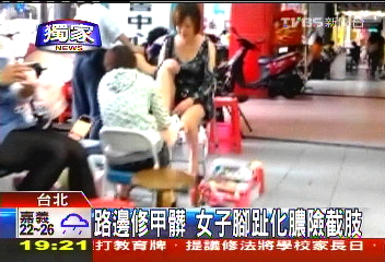〈獨家〉路邊修甲髒 女子腳趾化膿險截肢