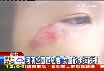 河濱公園藏危機 女童散步摔破相