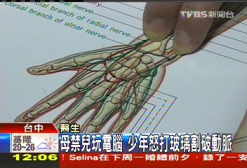 母禁兒玩電腦 少年怒打玻璃割破動脈