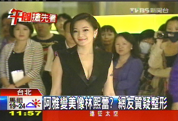 阿雅變美像林熙蕾? 網友質疑整形