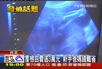 產檢自費逾3萬元 新手爸媽錢難省