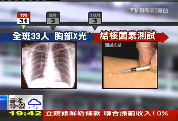 〈獨家〉國二生染肺結核 近半班得服藥9月