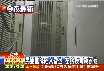 男嬰重摔陷入昏迷 左臉瘀青疑家暴