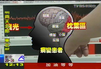暮光結局「光太閃」 美2例癲癇發作