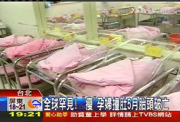 全球罕見！　「瘦」孕婦撞肚5月胎頭破亡
