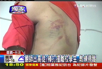 〈獨家〉嚴師出高徒?棒打擅離校學生 教練停職