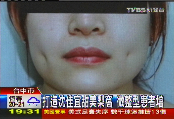 打造沈佳宜甜美梨窩 微整型患者增